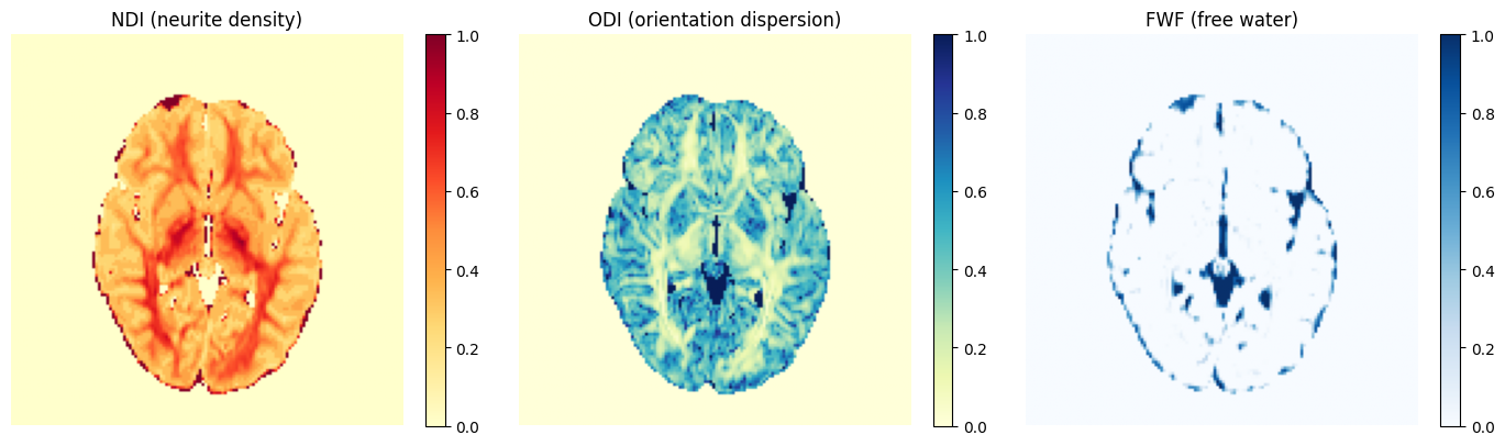 NODDI estimate for a particular subject